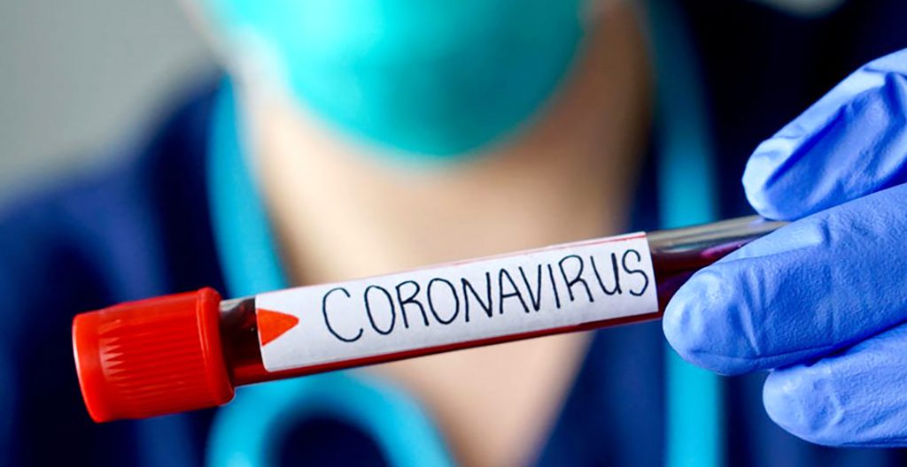  Ministerio De Salud Regional Reporta 206 Nuevos Casos Diarios De Coronavirus En La Araucanía