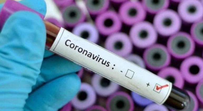  Coronavirus en La Araucanía: Hoy viernes se informaron 8 muertes y 1.005 nuevos contagios