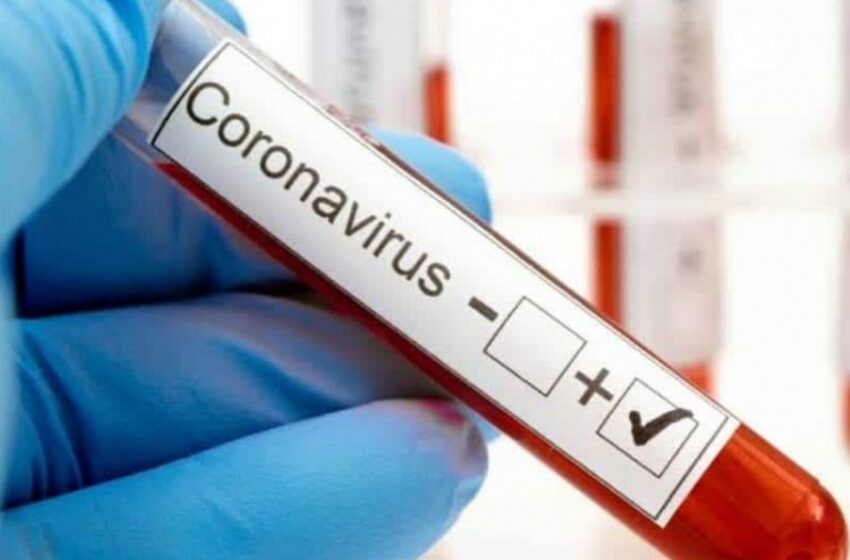  Este domingo se informaron un muerto y 750 nuevos contagios de COVID-19 en La Araucanía