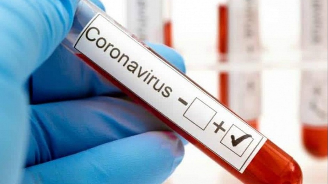 Sobre los 800 Contagios Por Covid Se Reportaron Hoy Con Más De 4 Mil PCR Realizados En La Araucanía
