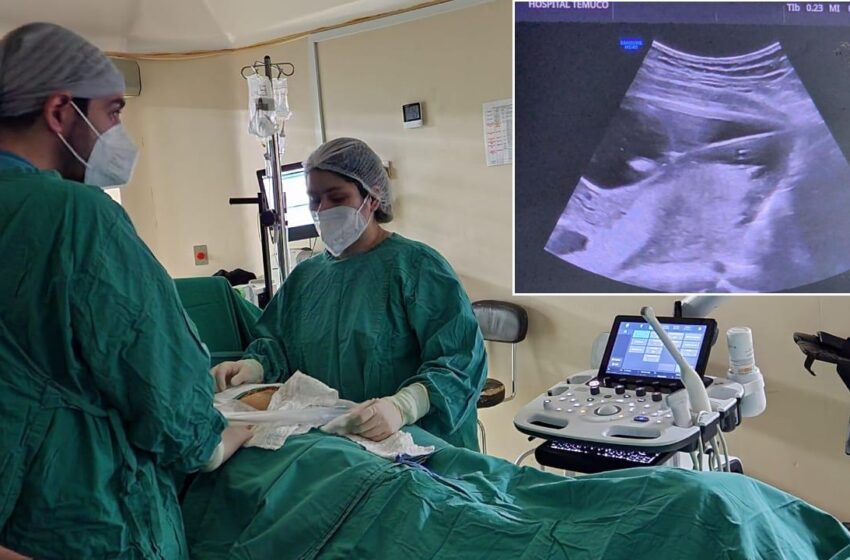  Hospital Dr. Hernán Henríquez Aravena Realizó Primera Cirugía A Feto De 19 Semanas Dentro Del Vientre Materno