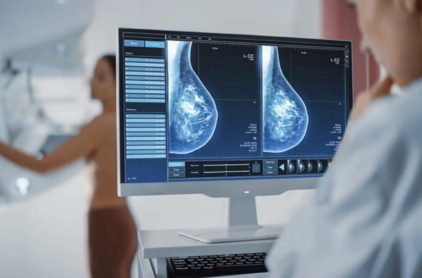  En Villarrica Con Mamografías Gratis Promueven La Prevención Del Cáncer